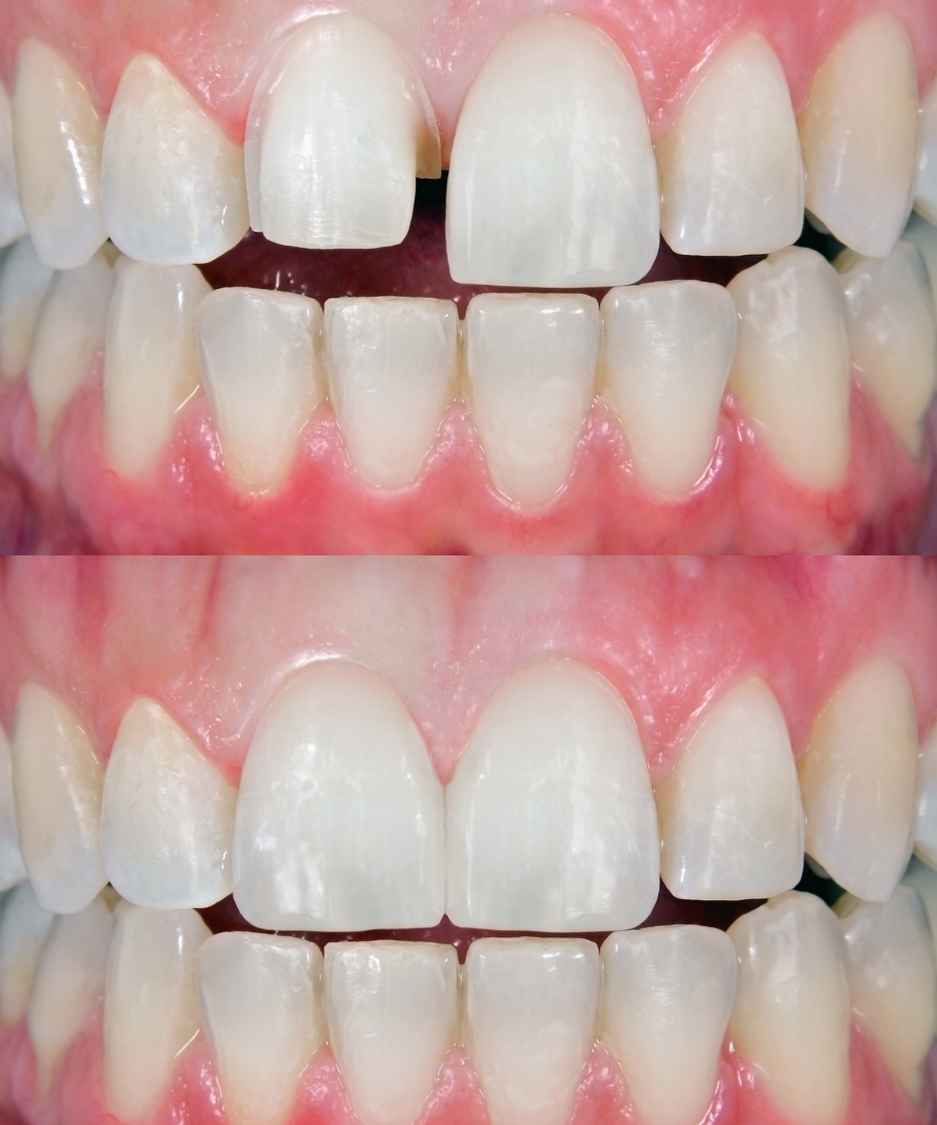 Lavoro odontoiatrico 7, confronto fotografico
