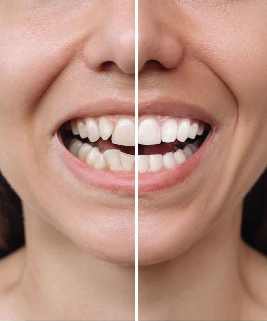 Lavoro odontoiatrico 1, confronto fotografico