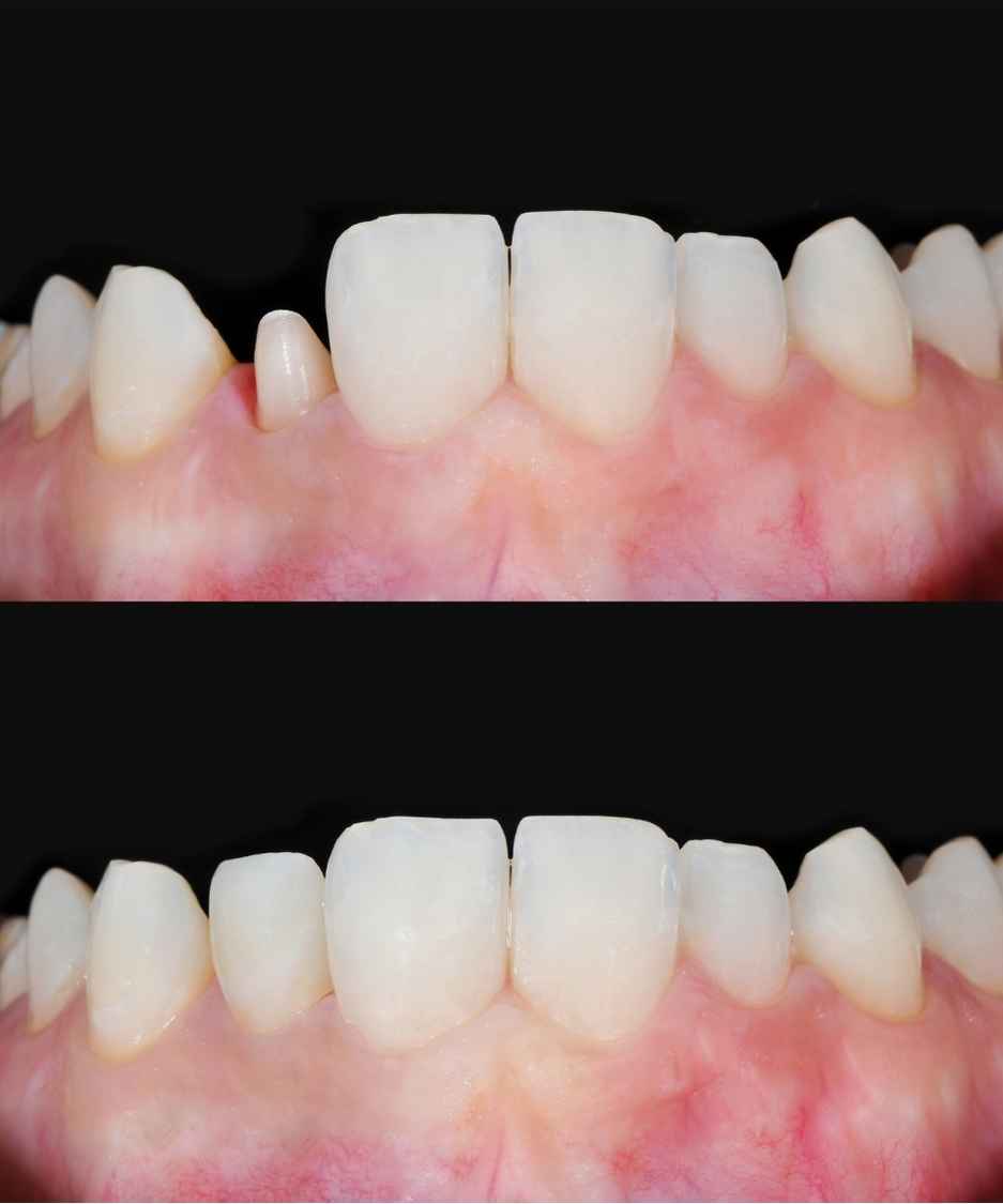 Lavoro odontoiatrico 9, confronto fotografico
