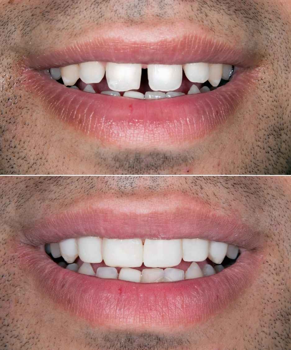 Lavoro odontoiatrico 4, confronto fotografico